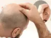 Evolução tecnológica traz soluções para autoestima masculina